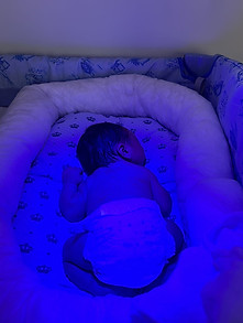 bebê em banho de luz azul para icterícia dormindo no berço