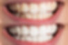 UNADJUSTEDNONRAW_thumb_62fc.jpg