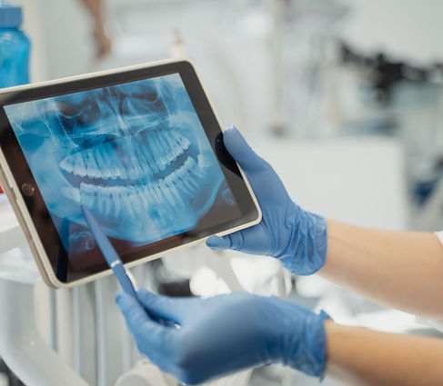 e-plantdental5.jpg