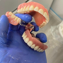 complete denture