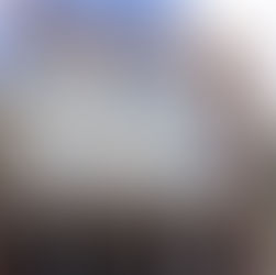 Servidores sofrem com falta de exames e Câmara de Arcoverde cobra do Sassepe pagamento aos laboratórios