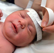 Famílias podem solicitar benefício por síndrome da Zika