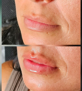 AshleeLanglelips.jpg