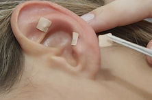 auriculoterapia.jpg