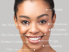 Rediscover Your Youth with Dermal Fillers at Triangle Laser & Aesthetic Center