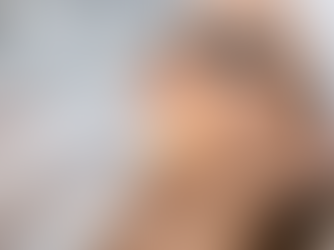 IPL (Intense Pulsed Light) Treatment: A Gentle Solution for Clearer, Brighter Skin