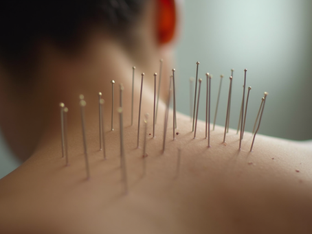 How Acupuncture Alleviates Anxiety Naturally