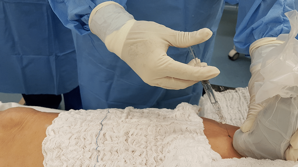 Procedimento na Coluna com Ácido Hialurônico