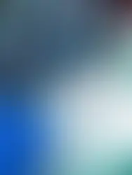 Abscesso Cerebral: Infecção grave que exige tratamento imediato