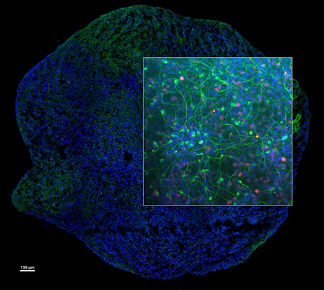 Brain_2021 (2).PNG