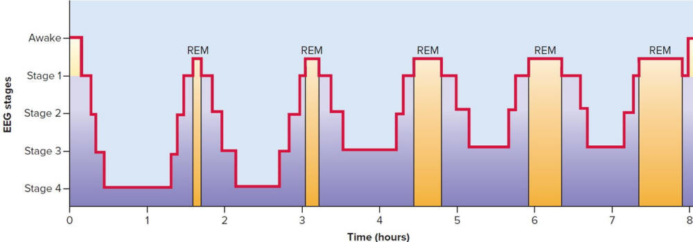 A typical hypnogram showing sleep stages and cycles in adult sleep
