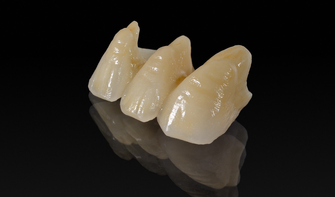 Bluestone Dental Hong Kong