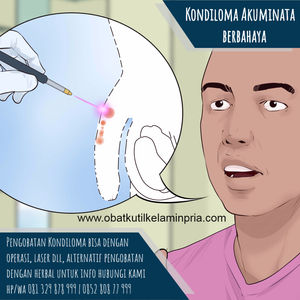 Obat Kutil Kelamin Menurut Dokter