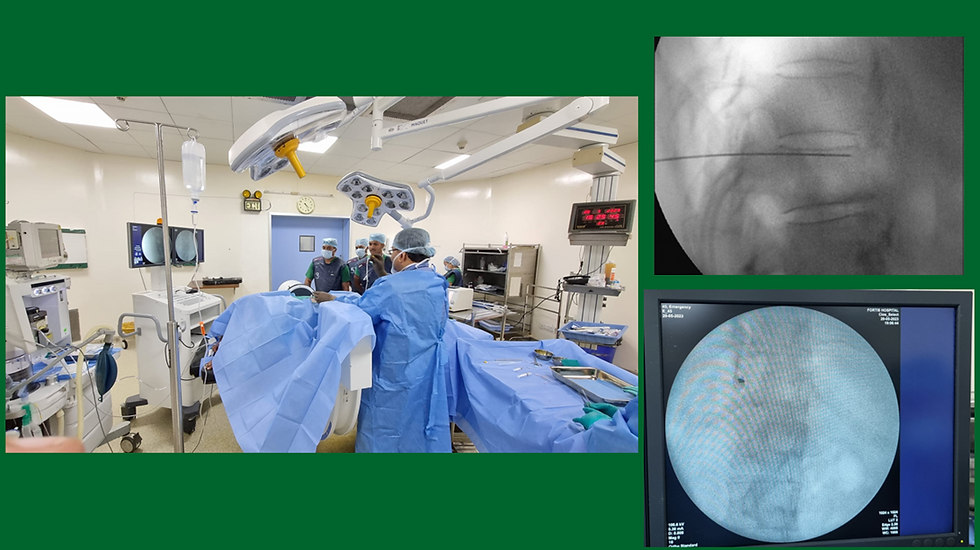 Dr. Debjyoti Dutta performs fluoroscopy-guided splanchnic nerve RF ablation at Asian Pain Academy.
