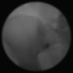 Grayscale side-view X-ray of a human skull and jaw, showing the head in profile against a dark background.contrasr in the Target For Sacroiliac joint injection under the C-arm