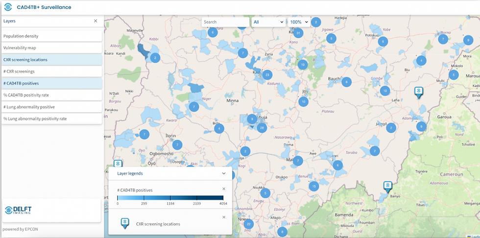 CAD4TB+: A New Era for TB Detection and Surveillance - we launch the World’s first All-in-One TB Intelligence Platform