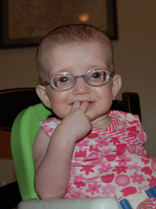 neonatal Marfan syndrome, early onset Marfan syndrome, infantile Marfan syndrome