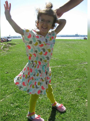 neonatal Marfan syndrome, early onset Marfan syndrome, infantile Marfan syndrome