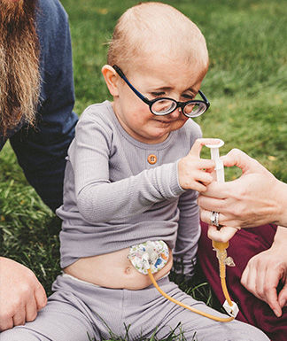 neonatal Marfan syndrome, early onset Marfan syndrome, infantile Marfan syndrome