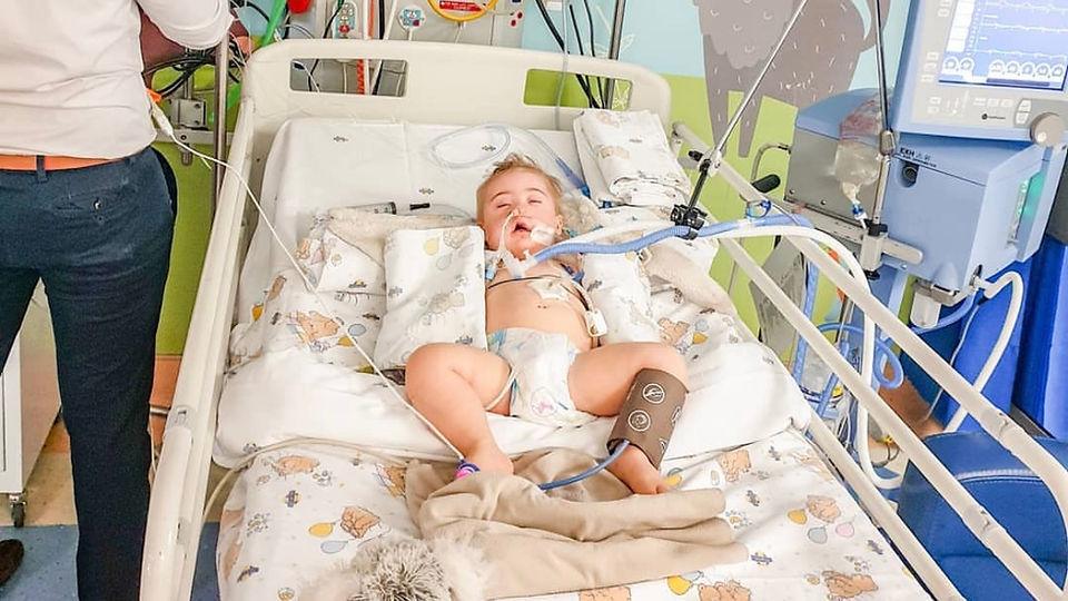 Baby with Down Syndrome in Pediatric Intensive care unit after airway collapse and intubation