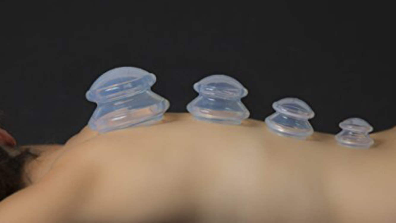 Cupping Massage 