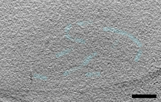 Measles_virus_17Feb_100nm_gif.gif