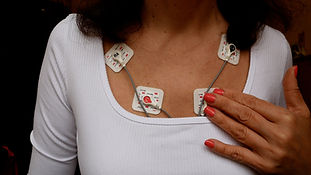 Menopause and Cardiovascular Risk: Understanding 
the Role of Hormones and Lipids 