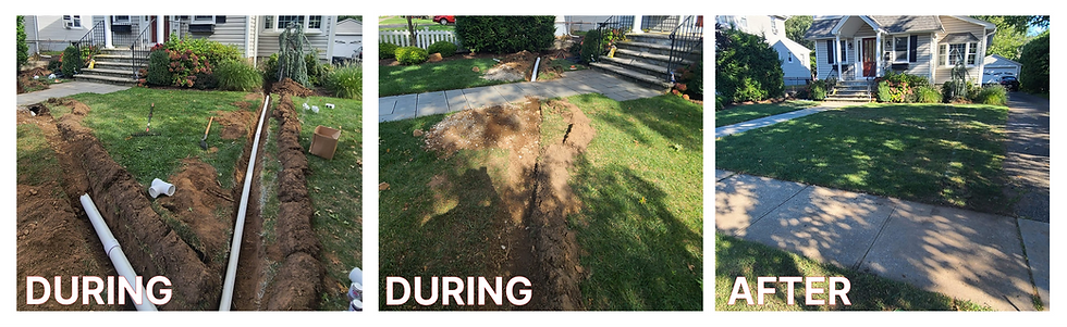 drainage after