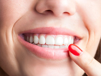 What Are Immediate Dentures? A Comprehensive Guide