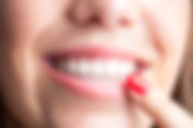 What Are Immediate Dentures? A Comprehensive Guide