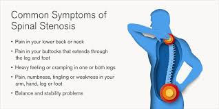 Living with Spinal Spinosus — What It Means and What to Expect from Bodywork