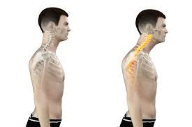 Rounded Shoulders and Text Neck — Understanding Modern Posture and How to Unwind It