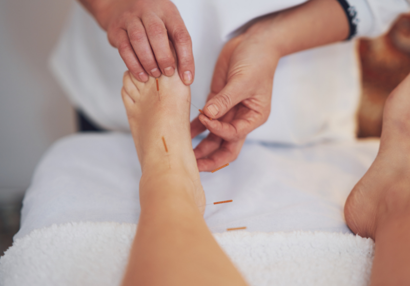 Acupuncture is the Treatment Options for Ankle Pain