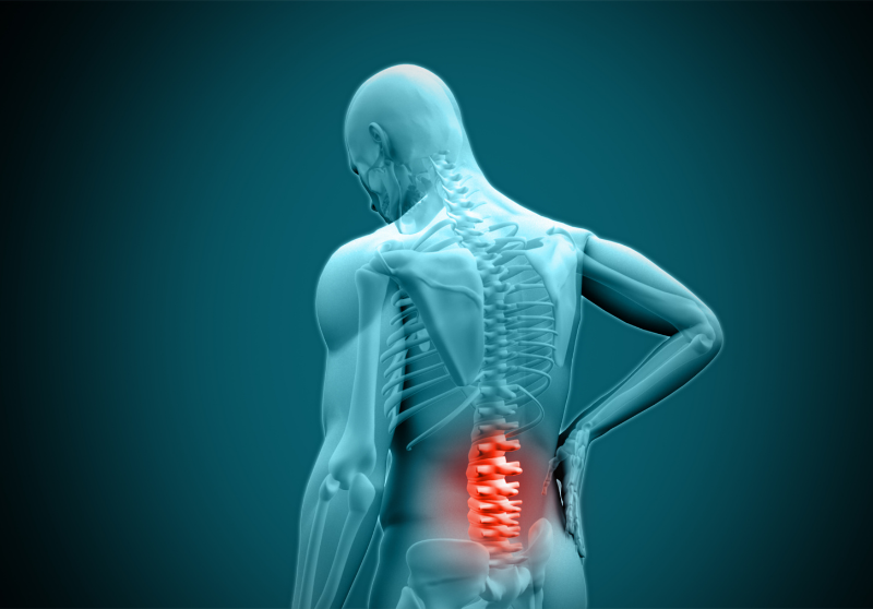 Lower Back and Sciatic Pain: Understanding the Cause and Finding the Right Approach to Recovery
