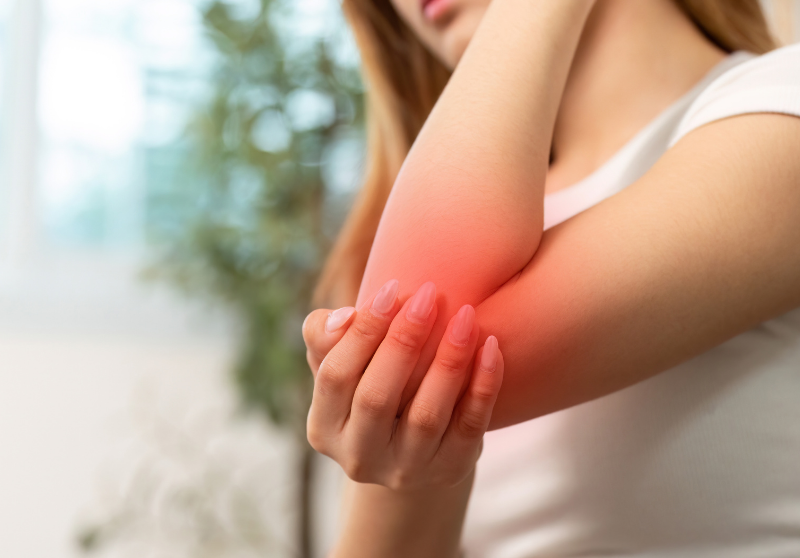Tennis Elbow (Lateral Epicondylitis): Causes, Symptoms, and the Most Effective Treatment for Elbow Pain