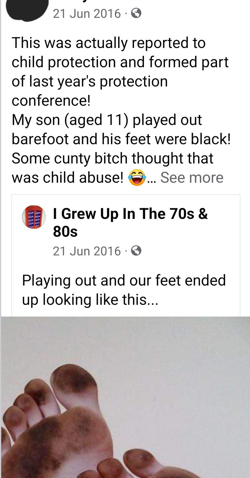 Black feet reported to child protection