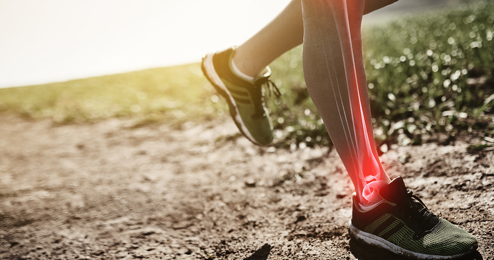 A runner with shin splints.