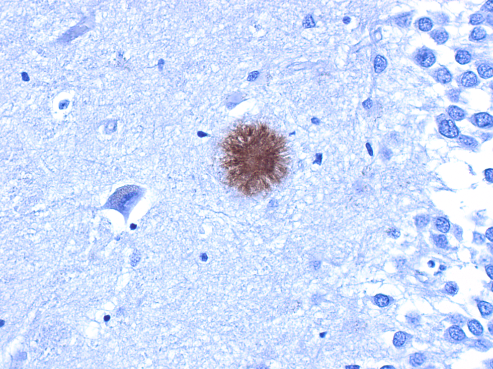beta amiloide hipocampo3.tif