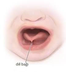 Dil Bağı