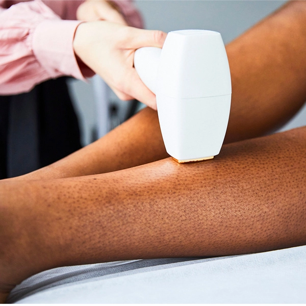 Epilation-laser - Copie.webp