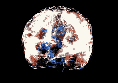 Brainstorm.gif