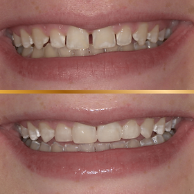 BeforeAfter (7).png