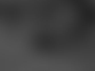 Que peut faire votre ostéopathe de Champhol Chartres en cas de canal lacrymal bouché chez le bébé ?