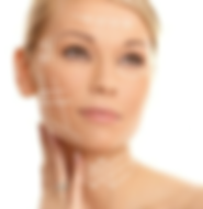 Hilos facial piel lifting