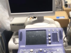 Hitachi Ultrasound Prosound  alpha10
