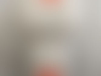 Toshiba Ultrasound probe（transducer） PLT-704SBT