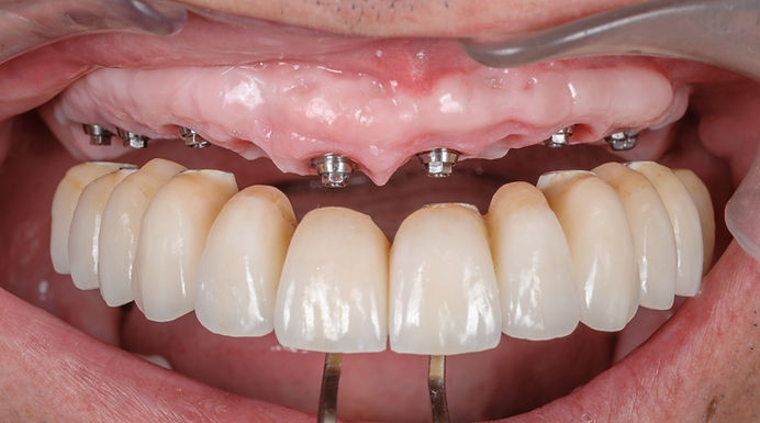 CASE 7B.jpg