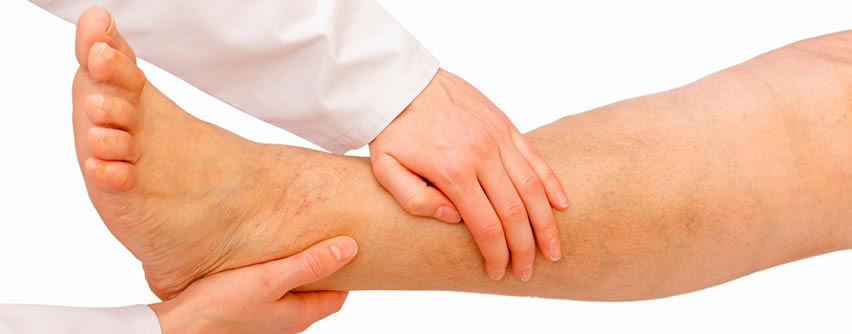 Guia Para Pacientes Con Ulceras Venosas