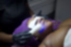 Led treatment