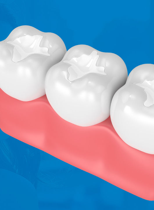 Sealants 3D.jpg